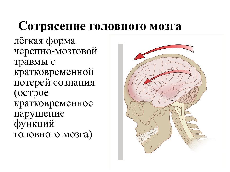 Чмт картинки для презентации