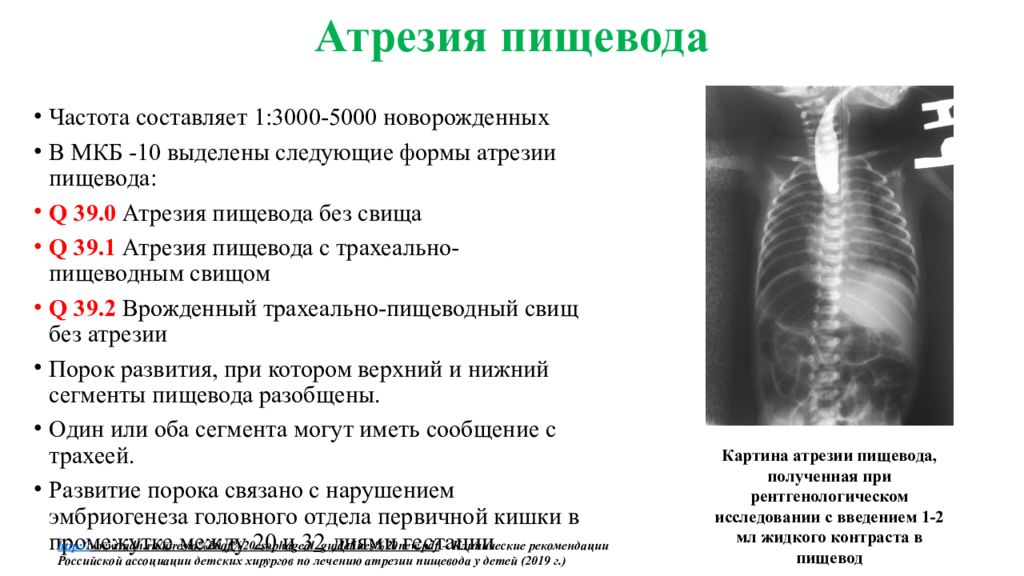 Заболевания и повреждения пищевода презентация