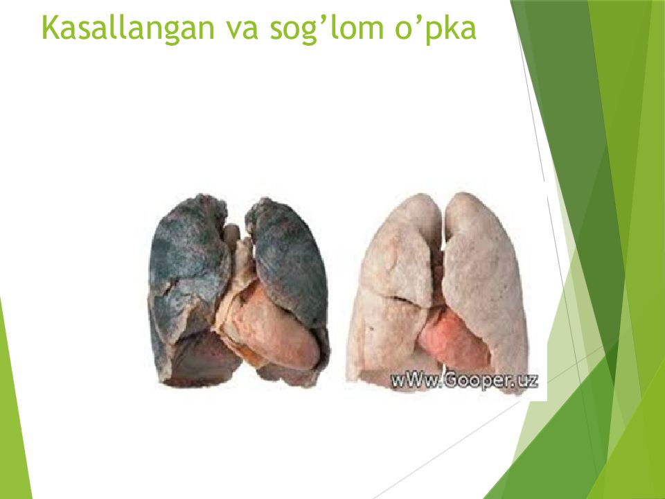 O'PKA OBSTRUKTIV YETISHMOVCHILIGI DIAGNOSTIKASI Kasallangan va sog’lom o’pka