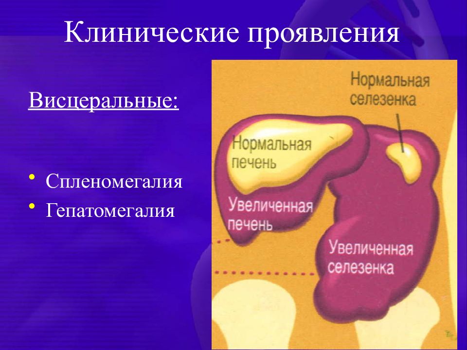 Умеренная спленомегалия у взрослого что это