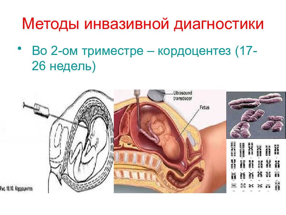 Методы обследования в акушерстве презентация