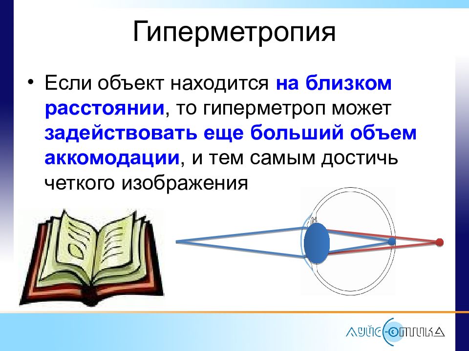 Гиперметропия что это. Гиперметроп. Аметропия и гиперметропия. Гиперметропия это в офтальмологии. Аметропия это в офтальмологии.