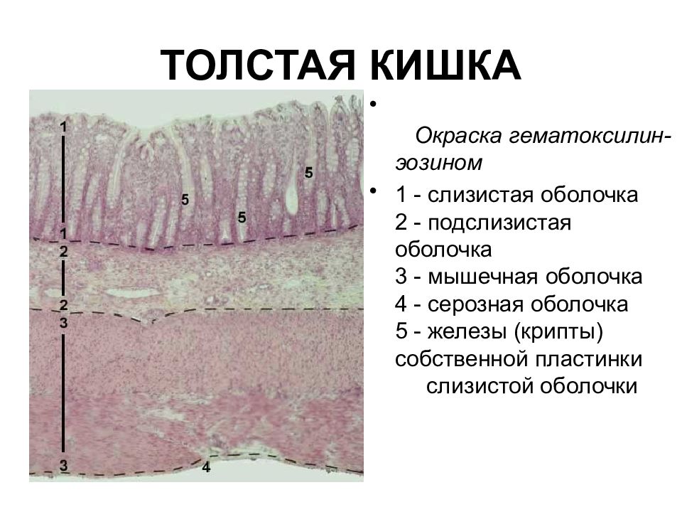 Толстая кишка гистология. Толстая кишка окраска гематоксилин-эозином. Товста кишка гистология. Толстый кишечник гистология препарат. Гистологический препарат толстой кишки.