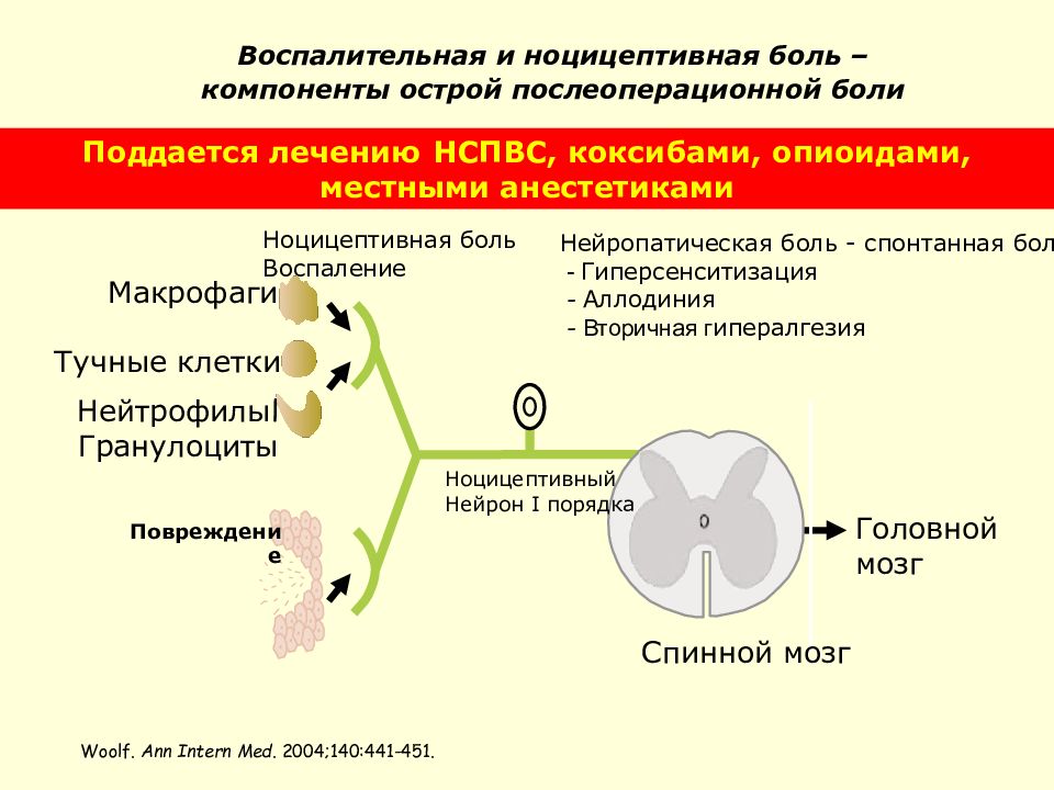 Ноцицептивная боль схема