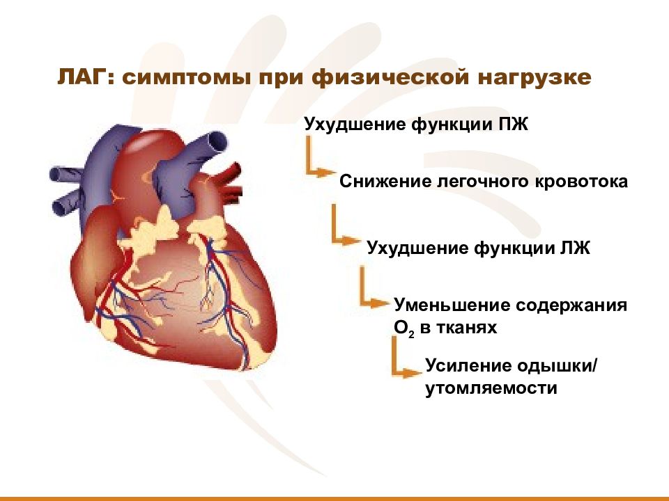 Легочная артериальная гипертензия презентация