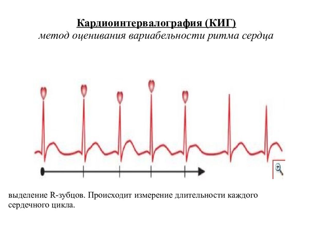 Расшифровка сердец. Кардиоинтервалография. Кардиоинтервала графия. Кардио интервалография. Кардиоинтервалография аппарат.