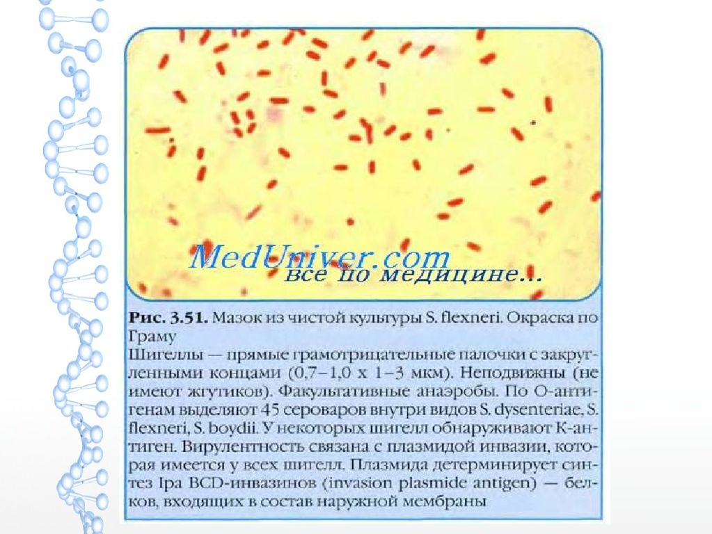 морфологическая характеристика шигелл. шигеллы характеристика возбудителя. морфология и тинкториальные свойства. морфологическая характеристика шигелл. шигеллы характеристика.