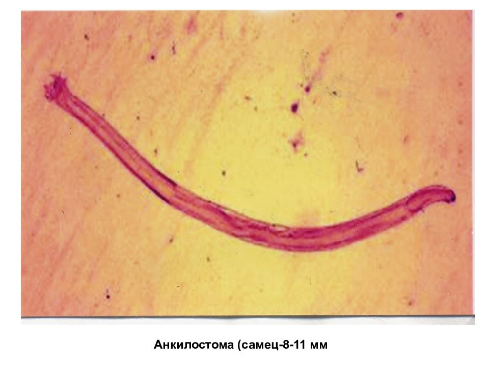 Острица фото под микроскопом. Тотальный препарат Enterobius vermicularis. Enterobius vermicularis паразитический червь. Острица Enterobius vermicularis самка.