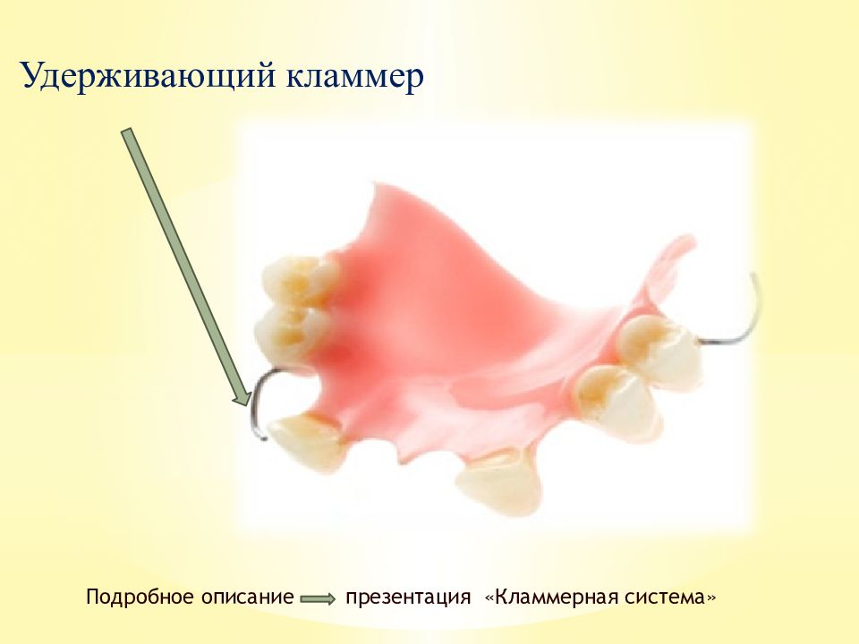 Пластиночные протезы презентация