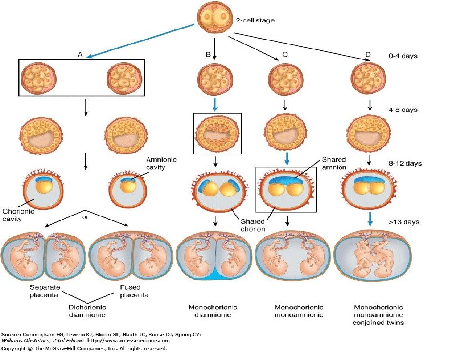 Виды беременности. Монозиготная многоплодная беременность. Патогенез многоплодной беременности. Деление эмбриона на два плода. Деление клеток эмбриона по дням.