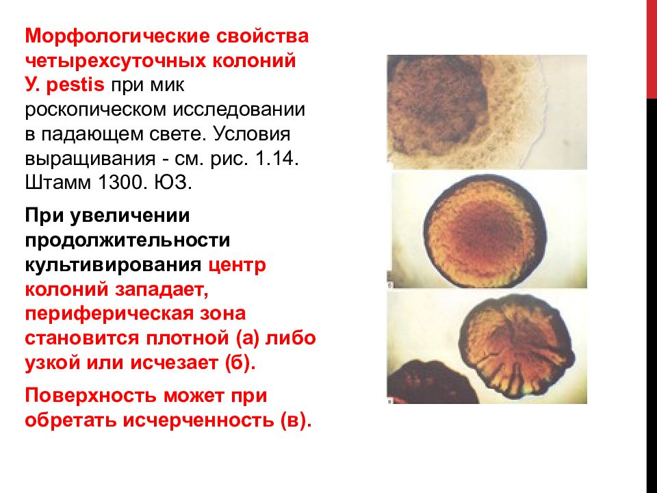 Туляремия презентация инфекционные болезни