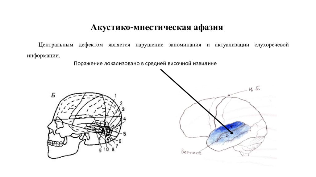 Операции процесса письма по лурия схема