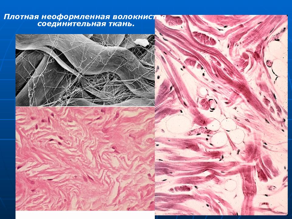По изображению с микроскопа в препарате кожи пальца в плотной соединительной ткани