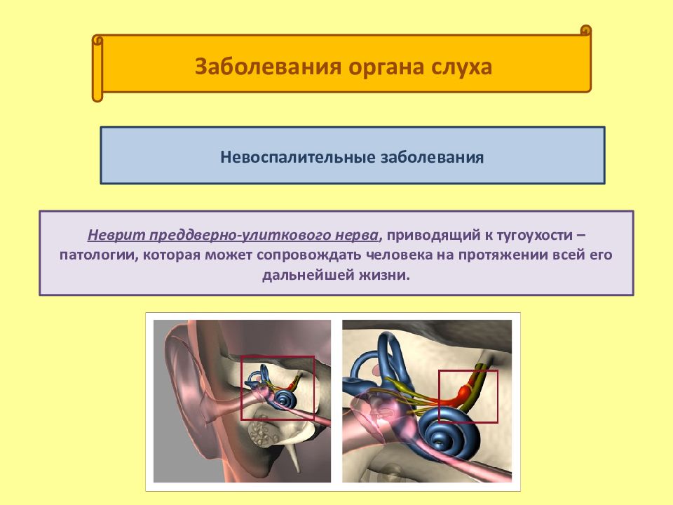 Заболевания слуха. Заболевания органов слуха. Нарушение органа слуха. Патология органов слуха. Нарушения и заболевания органов слуха.