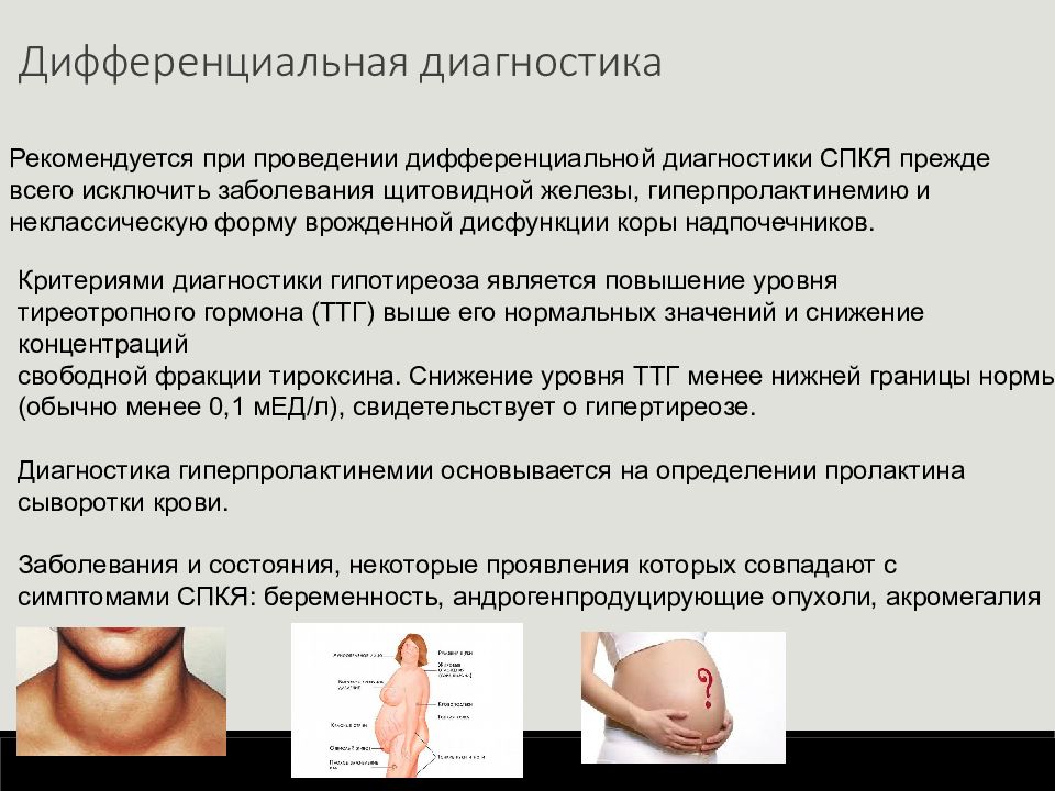 Поликистозные яичники симптомы. Синдром поликистозных яичников. Синдром поликистозных яичников симптомы. Синдром поликистозных яичников признаки.