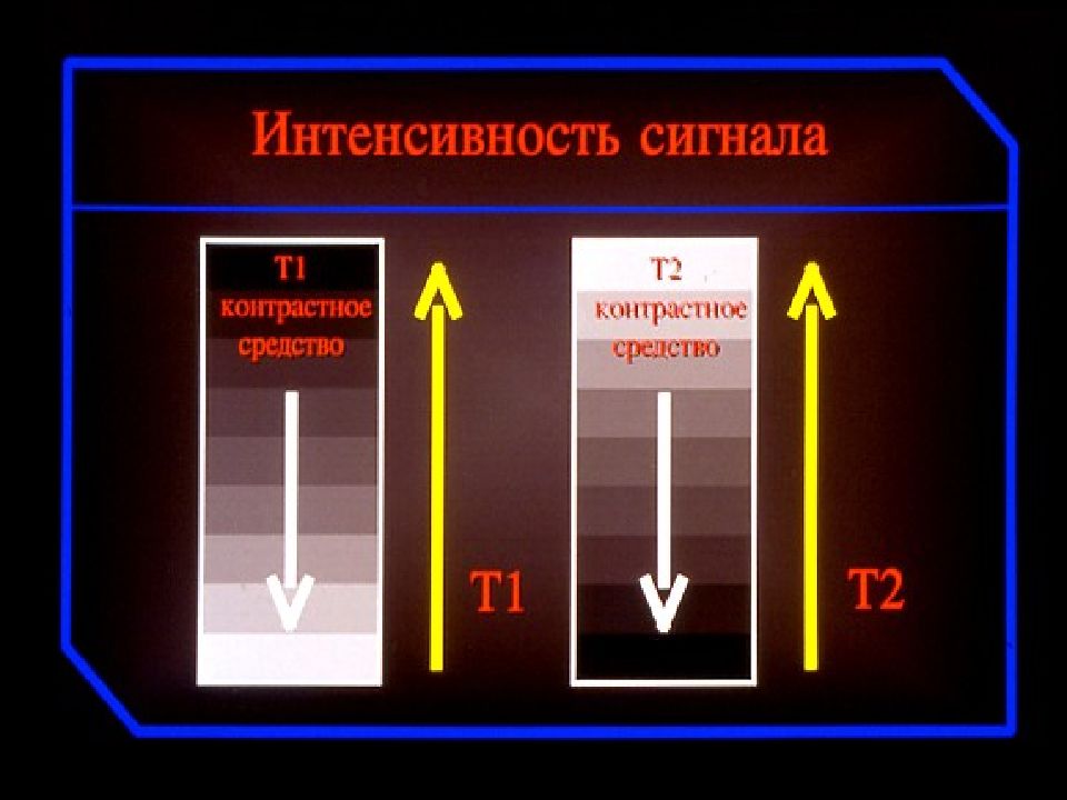 Контраст отзывы. Контрастные препараты для мрт. Магнито резонансные контрастные средства. Интенсивность сигнала мрт. Пониженная интенсивность сигнала.