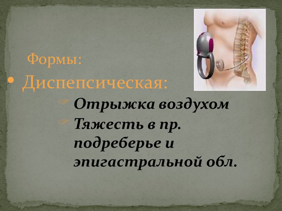 Боли в эпигастральной области отрыжка воздухом. Тяжесть в эпигастральной области. Отрыжка воздухом и боль в правом подреберье. Отрыжка при холецистите. Холецистит боль в левом подреберье.