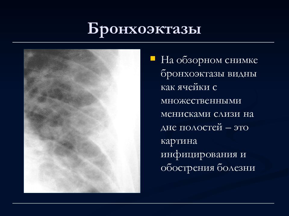 Методы лучевой диагностики органов дыхания презентация