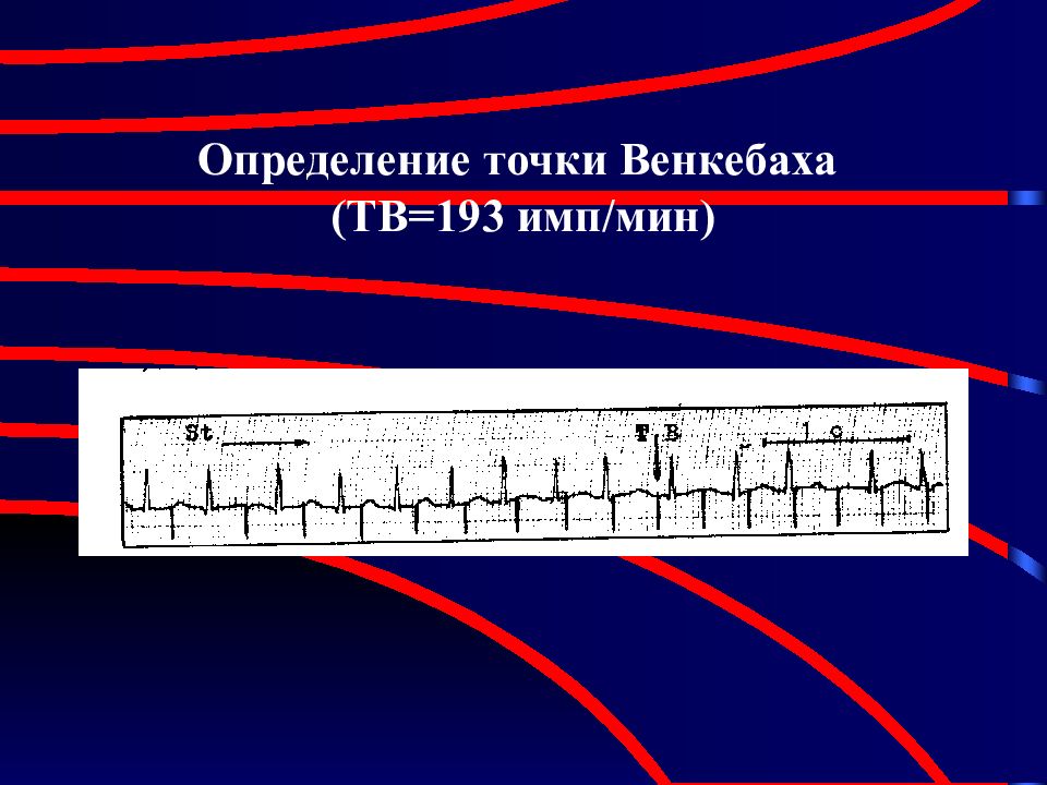 Электроимпульсная терапия презентация