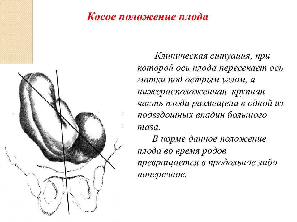 Презентация головка плода