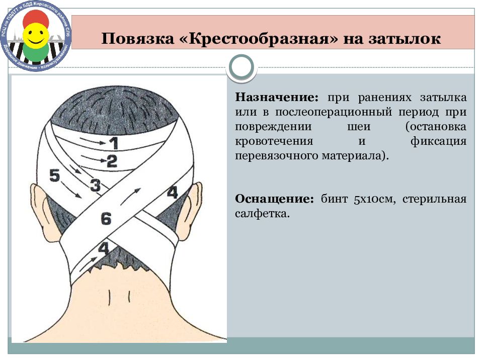 Крестообразная повязка