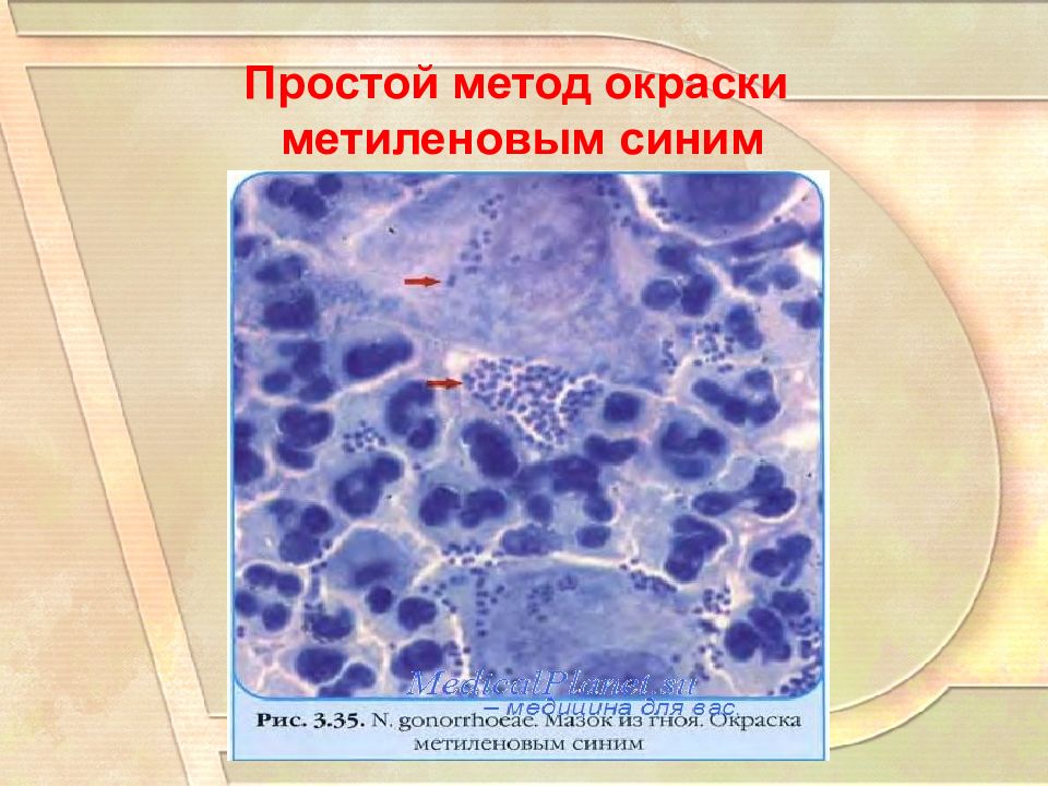 Окраска метиленовым синим