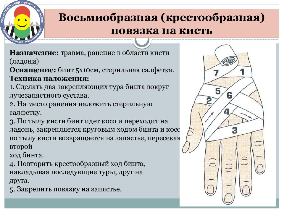 Крестообразная повязка. Восьмиобразная повязка на лучезапястный сустав. Алгоритм наложения крестообразной повязки на кисть. Крестообразная (восьмиобразная) повязка на кисть. Восьмиобразная повязка на кисть алгоритм.