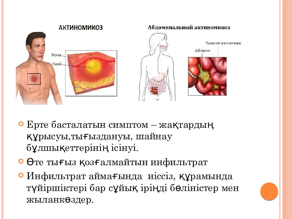 Балаларда сепсис казакша презентация