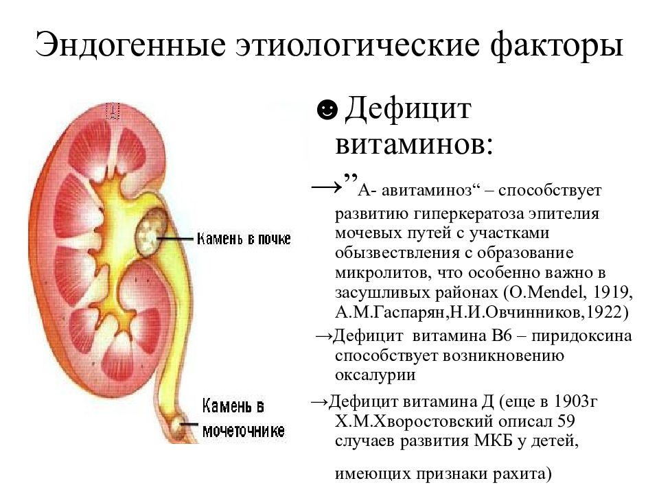 Микролиты в почках