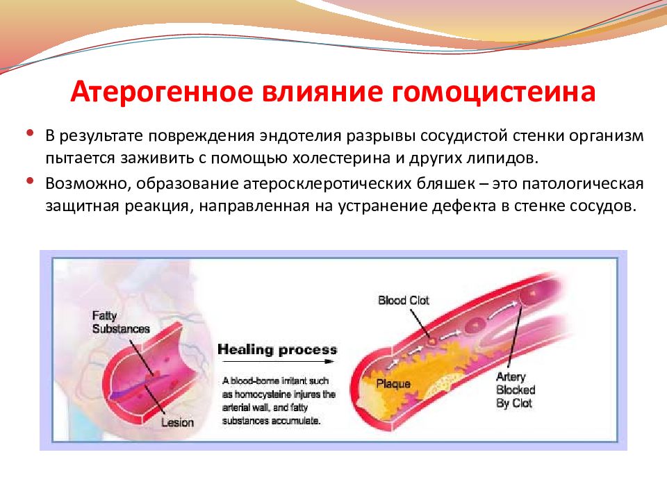 Гомоцистеин повышен. Атеросклероз презентация. Атеросклероз и гомоцистеин. Гомоцистеинемия и атеросклероз. Повреждение эндотелия сосудистой стенки.