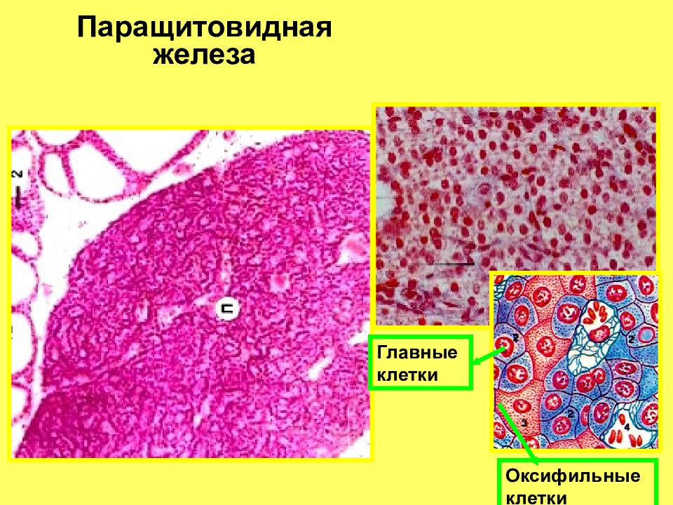 Какого цвета железы. Околощитовидная железа гистология препарат. Паращитовидная железа гистология препарат. Околощитовидная железа строение гистология. Клетки паращитовидной железы гистология.