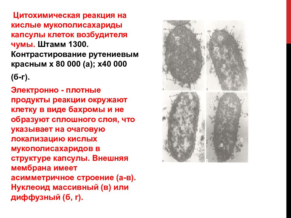 Туляремия презентация инфекционные болезни