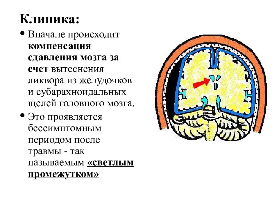 Черепно мозговая травма эпилепсия