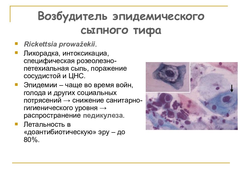 Периоды сыпного тифа. Риккетсии, хламидии, вирусы. Сыпной тиф факторы патогенности. Эпидемический сыпной тиф осложнения. Риккетсиоз возбудитель.