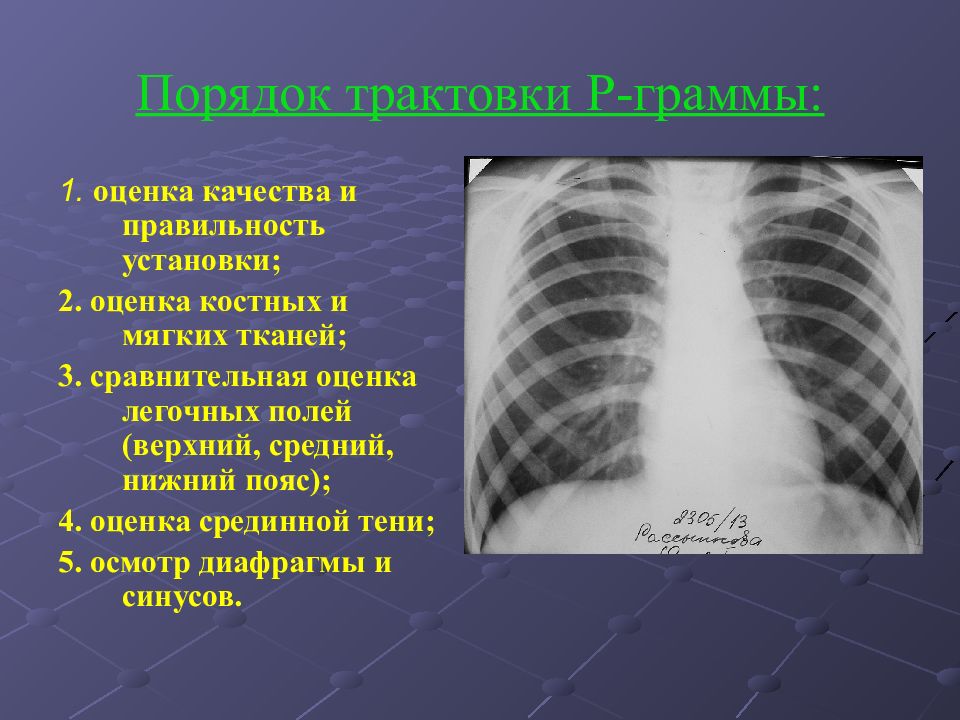 Диагностика легких. Лучевая диагностика заболеваний легких. Рентгенодиагностика легких. Рентгенодиагностика заболеваний легких. Заболевания легких рентгенология.