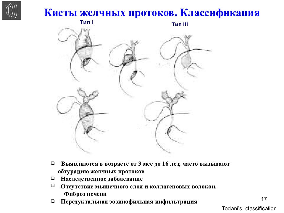 Гнойный холангит презентация