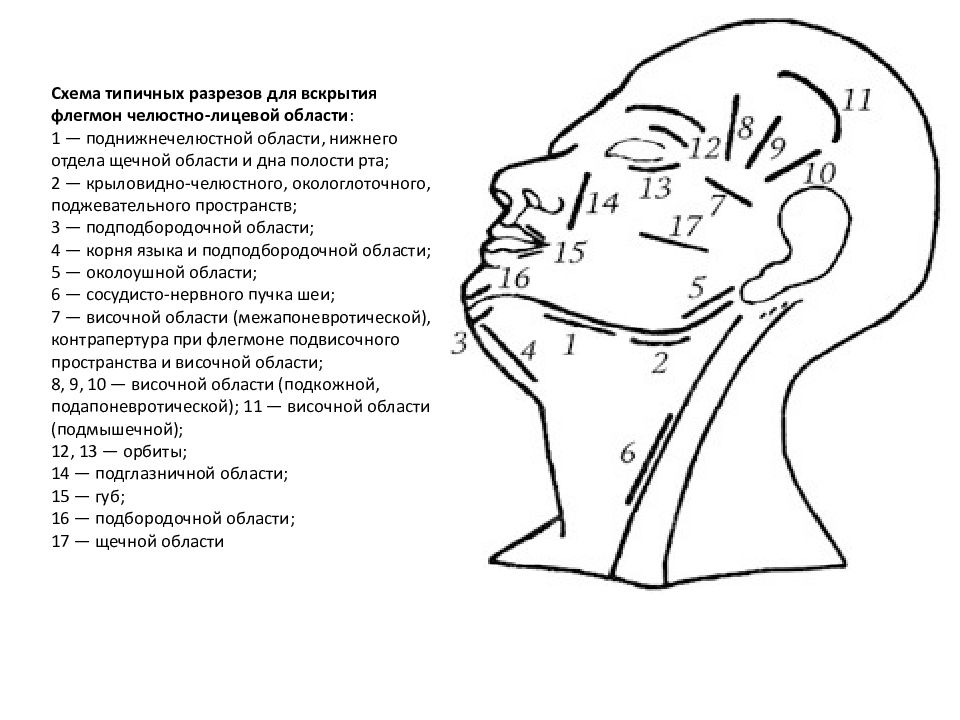 Абсцессы и флегмоны челюстно лицевой области презентация