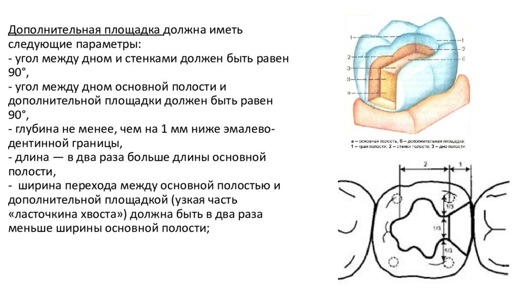 Вертикальная полость глубиной менее 20 м называется. Параметры дополнительной площадки. Дополнительная площадка стоматология. Параметры дополнительной площадки стоматология. Дополнительная площадка в полости зуба.