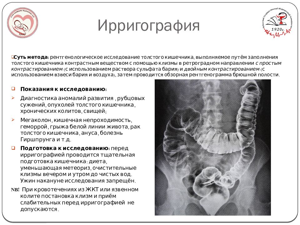 Ирригоскопия это рентгенологическое контрастное исследование. Ирригография кишечника. Рентгенологическое исследование толстой кишки (ирригоскопия). Ирригография методика исследования. Ирригография толстой кишки.