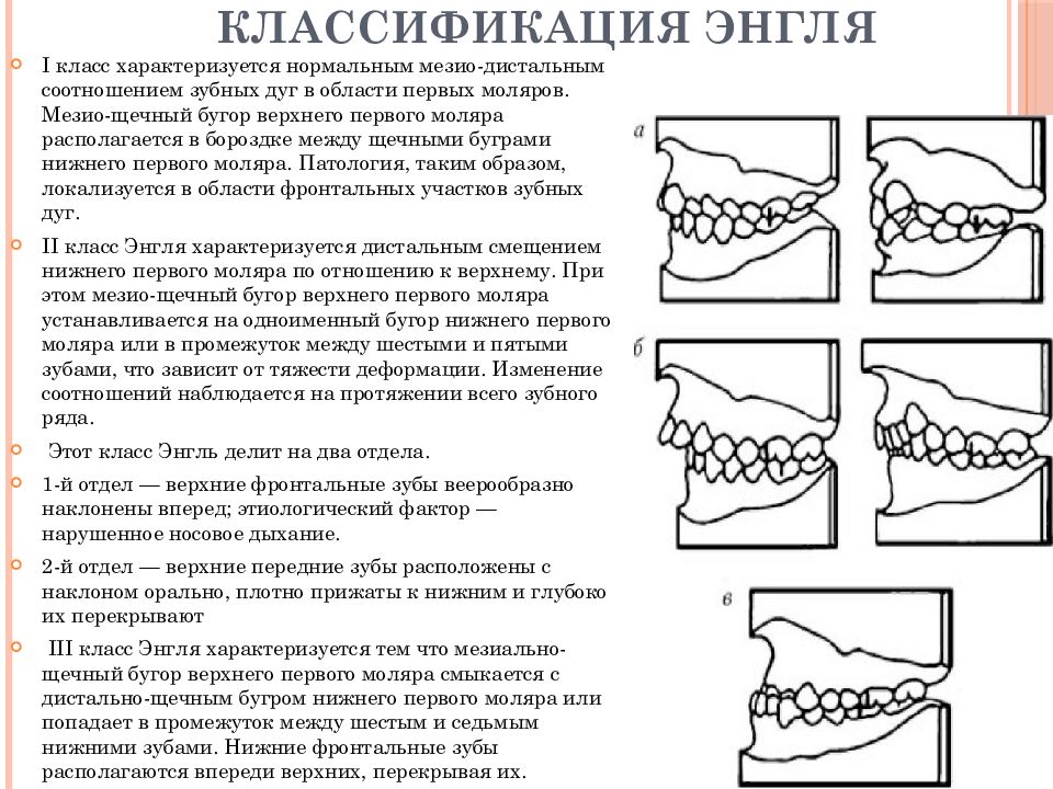 Хирургические методы в плане комплексного ортодонтического лечения