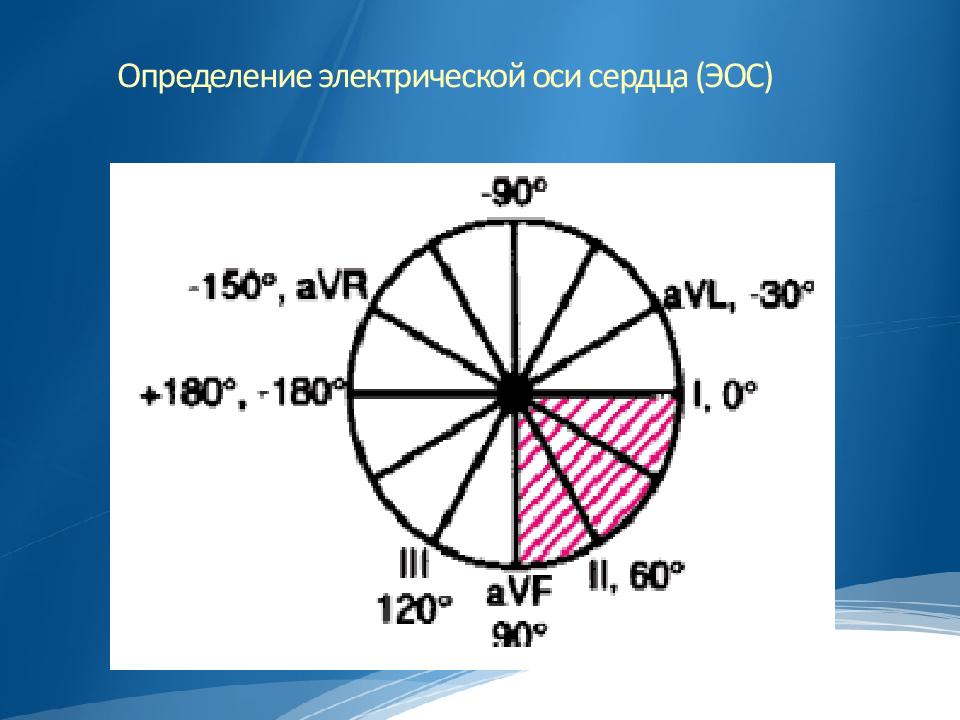 Определение осей сердца