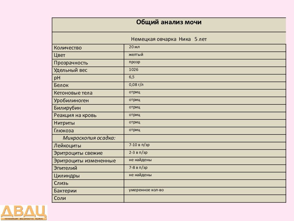 Сон писать моча. Общий анализ мочи презентация. Микроскопическое исследование мочи расшифровка. Анализ мочи удельный вес. ОАМ С микроскопией осадка.