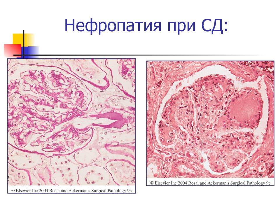 Нефропатия у кошек