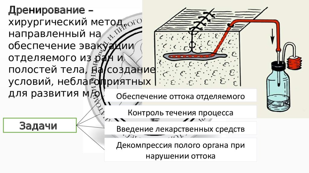 Дренаж ран. Дренирование антисептика. Физическая антисептика дренирование. Дренирование в обогащении. Антисептика дренирование РАН.