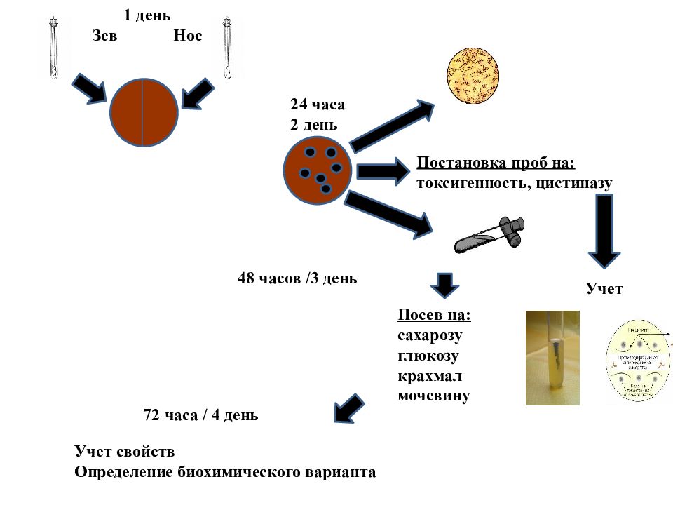 Схема бактериологическая диагностика дифтерии