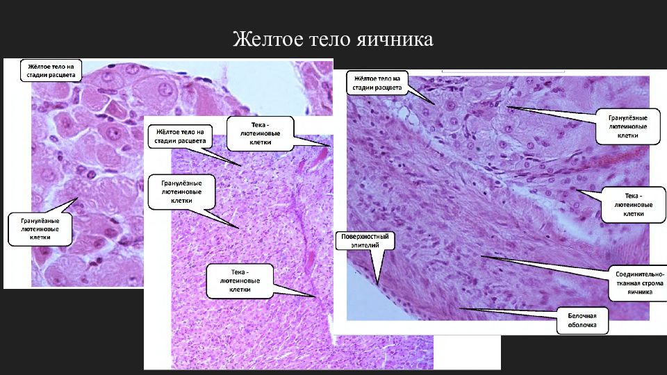 Структура яичника желтое тело