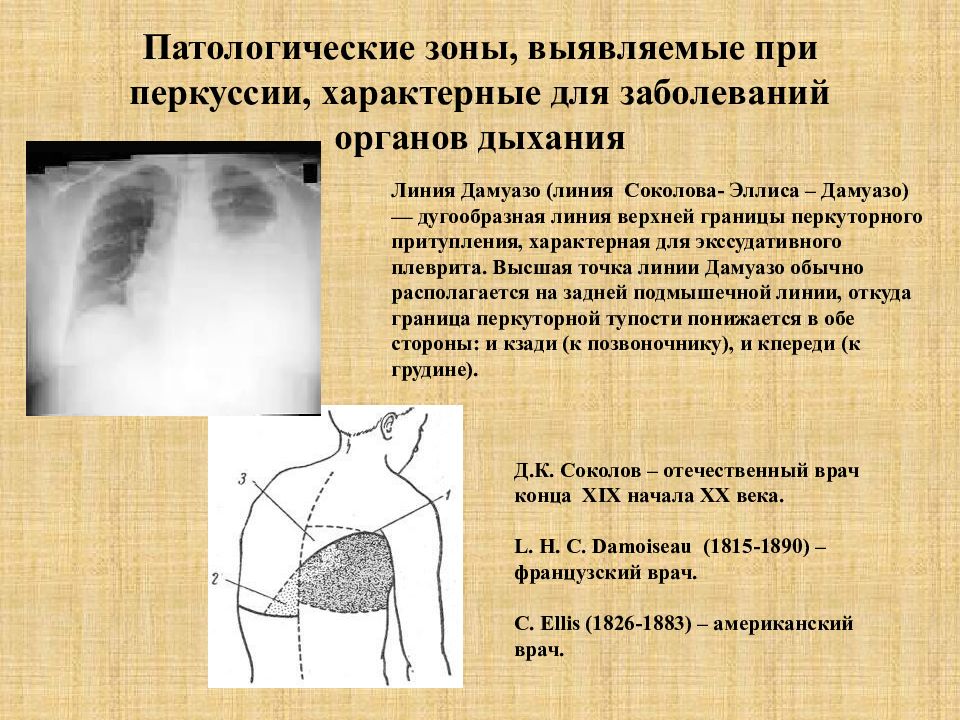 Треугольник Гарлянда, портал врачей Иркутской области и …