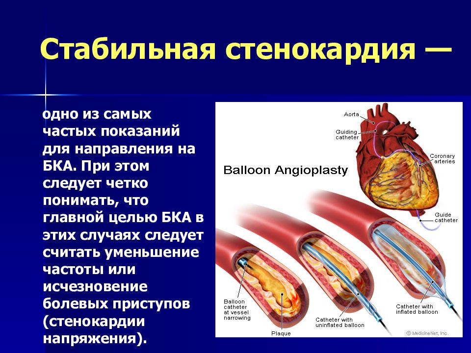 Ибс нестабильная стенокардия карта вызова