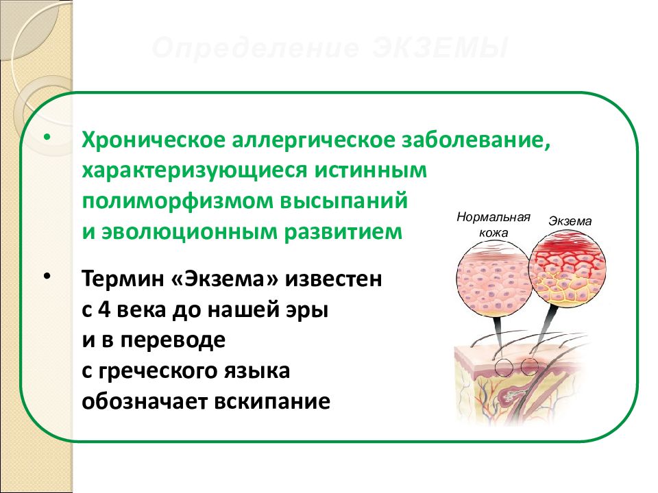 Отек квинке презентация