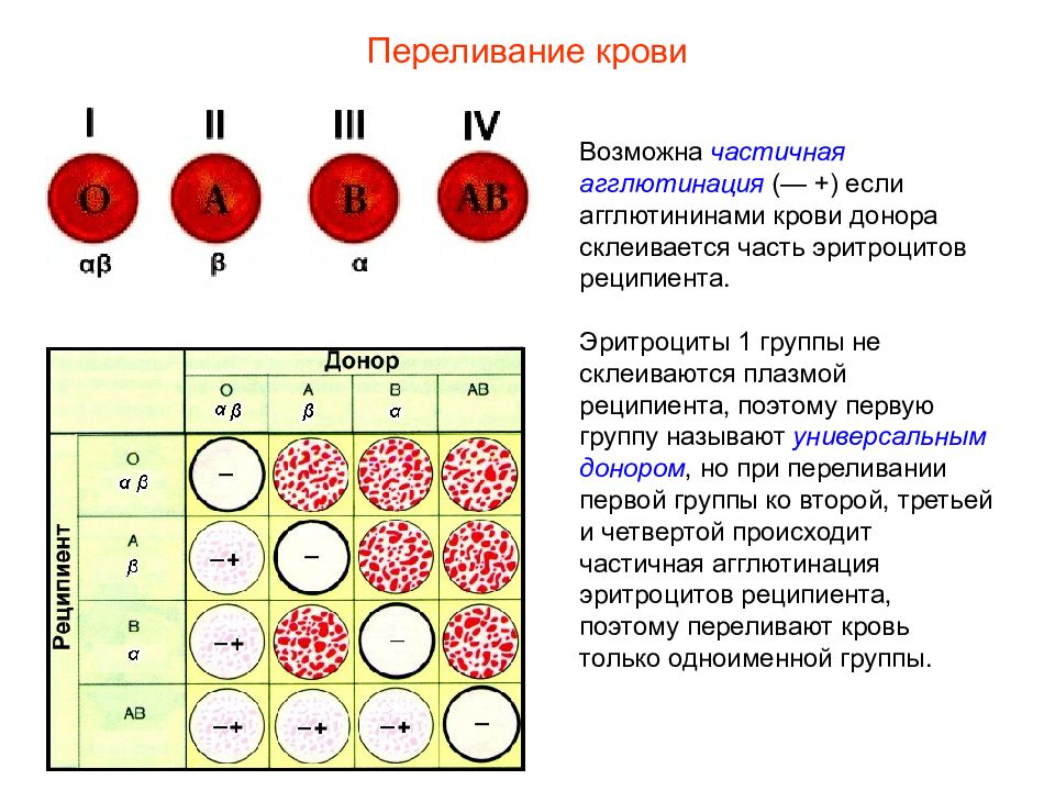 Схема переливания крови по группам крови